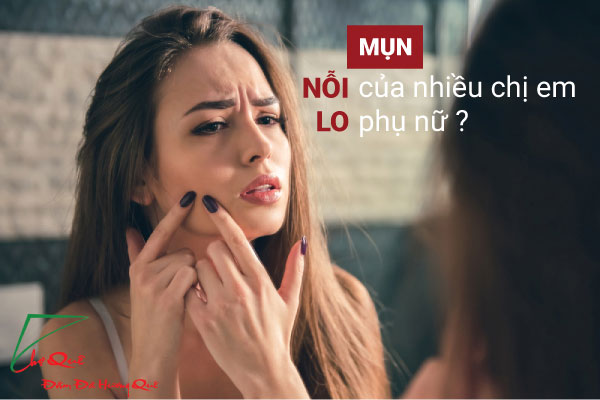 TRỊ MỤN HIỆU QUẢ NHỜ RÂU NGÔ